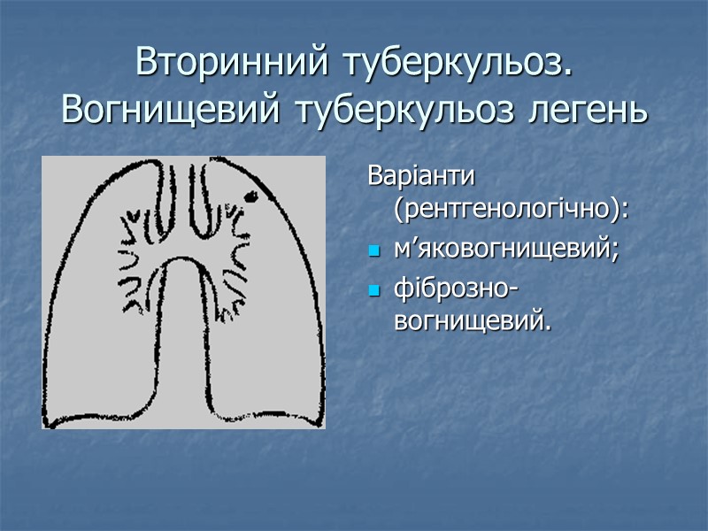 Вторинний туберкульоз. Вогнищевий туберкульоз легень Варіанти (рентгенологічно): м’яковогнищевий; фіброзно-вогнищевий.
